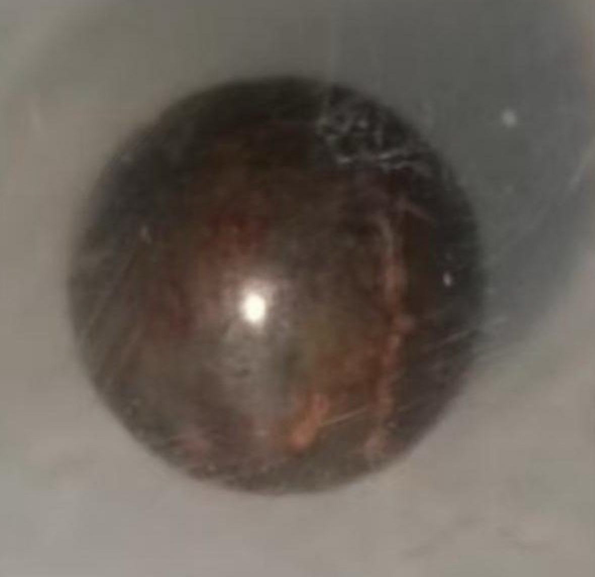 吳先生頭顱內取出的鋼珠。 大坪醫院供圖