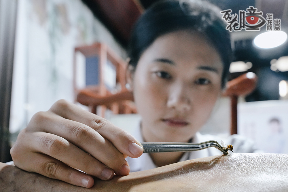 璧山區(qū)中醫(yī)院林玉婷醫(yī)生用鑷子夾住活蜂胸部，利用蜜蜂尾部螫針刺入皮膚并釋放蜂毒，除了治療風(fēng)濕性疾?。ㄈ顼L(fēng)濕、類風(fēng)濕性關(guān)節(jié)炎、強(qiáng)直性脊柱炎、硬皮病等）外，還能一定程度上治療靜脈曲張等一些臨床疑難頑固性疾病。