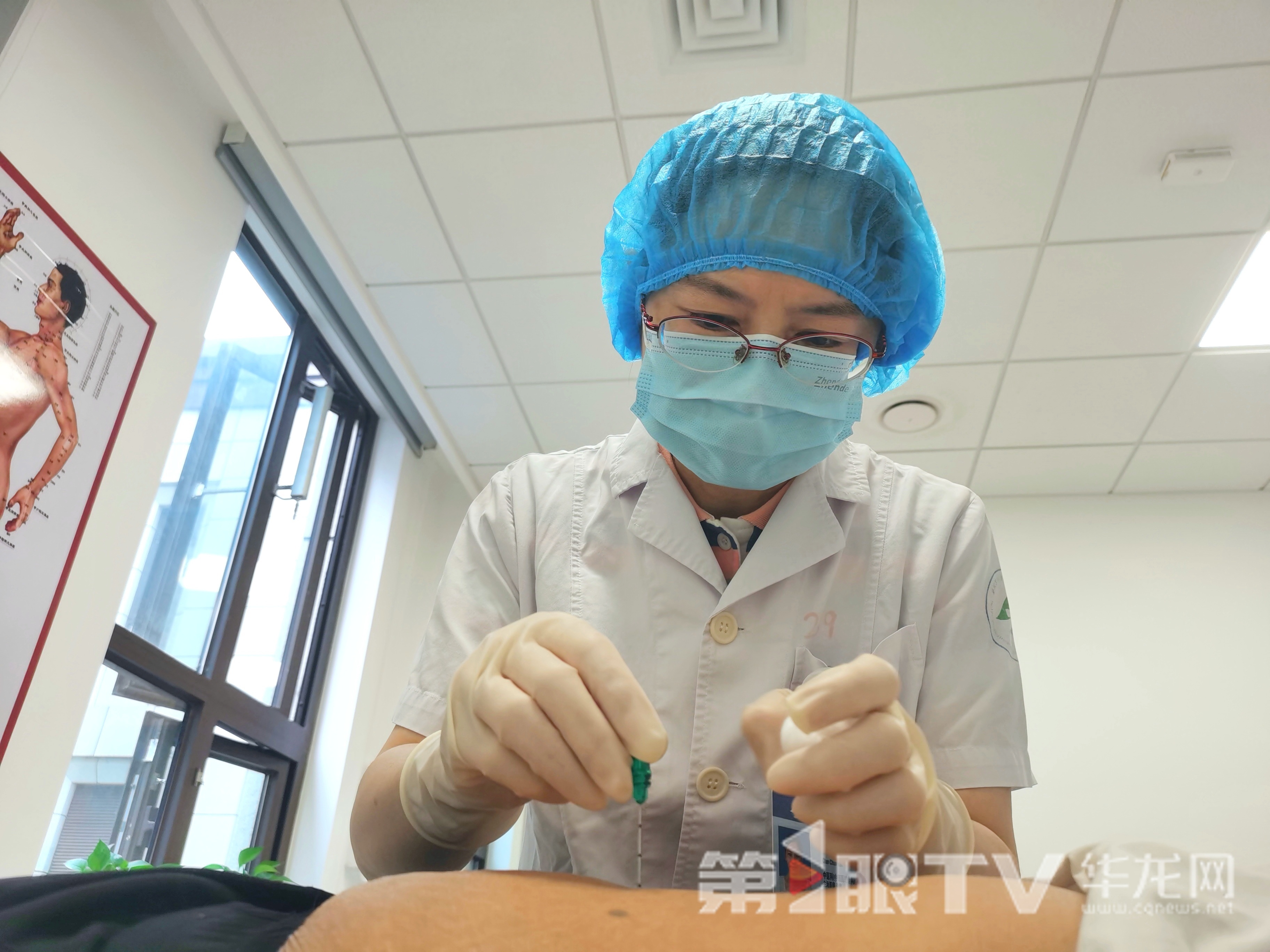专家给患者进行埋线。 第1眼TV-华龙网记者 陈洋 摄